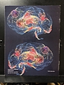 June 09 Supplement, Frontiers of Medical Research: Brian Science, 2023